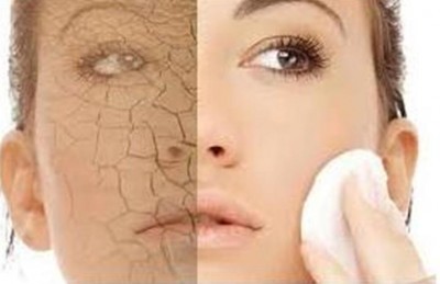 Dealing with Dry Skin the Natural Way