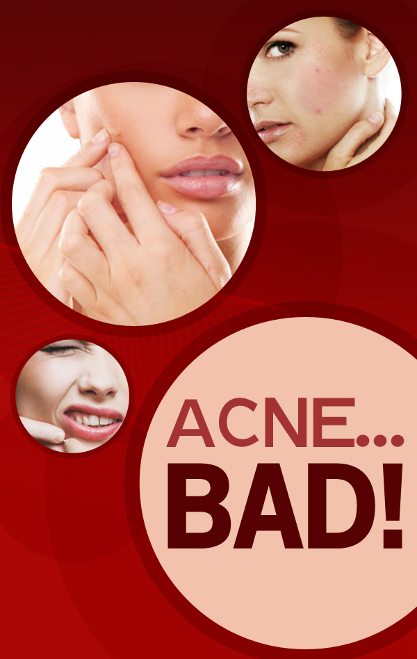 How to Care for Acne Prone Skin